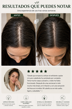 Avelia · Exfoliante Capilar Purificante — Limpieza Profunda del Cuero Cabelludo (100 g) 4